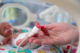 Skrining untuk bayi prematur melibatkan hampir seluruh bagian tubuhnya (Dok. Shutterstock)